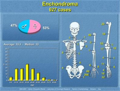 Distribuzione per età, sesso e sede del Condroma