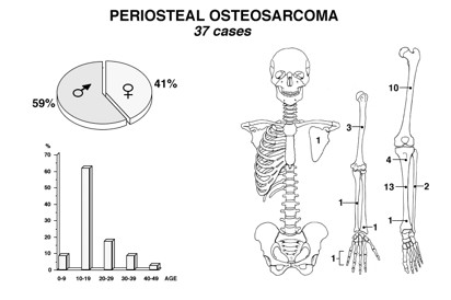 Osteosarcoma Periosteo