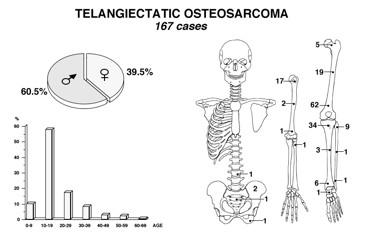 Osteosarcoma Emorragico o Teleangectatico